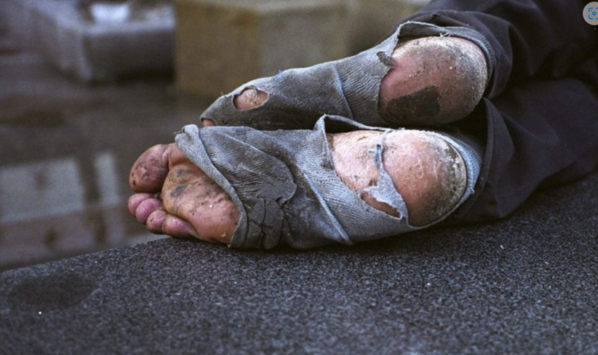 Homeless-Feet
